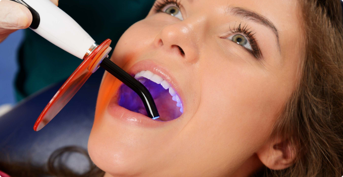 Laser Dentistry