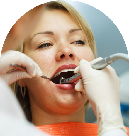 Root Canal Treatment