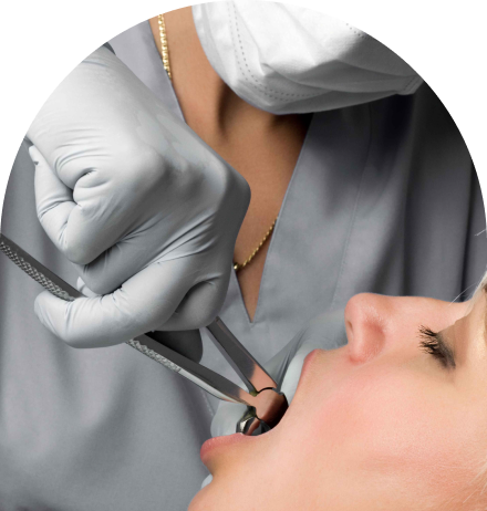 Dental Extractions