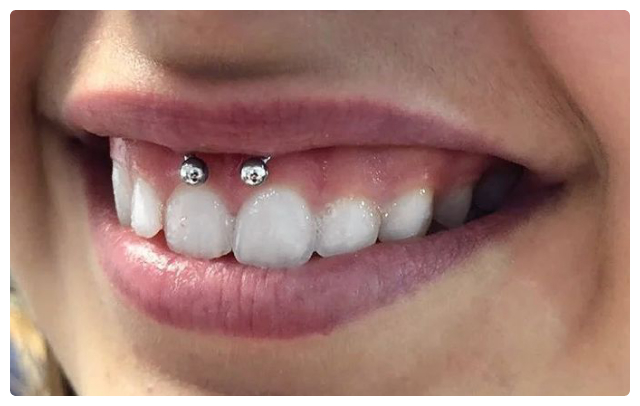 Piercings on teeth