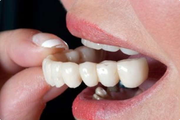 Root Canal Treatment